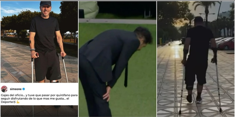 Simeone operato, si era fatto male contro l'Inter: lui ci scherza su 1 Simeone operato, si era fatto male contro l'Inter: lui ci scherza su