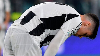 ArrivedAdzic: il rischio che corre la Juve dopo l’ultimo guaio muscolare 1 ArrivedAdzic: il rischio che corre la Juve dopo l’ultimo guaio muscolare