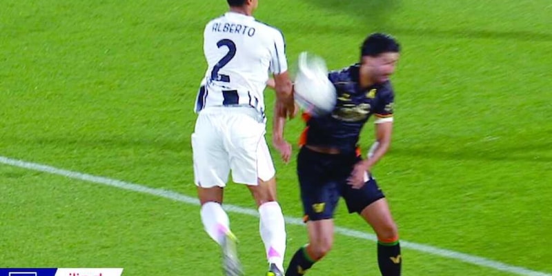 Moviola Venezia-Juve: Colombo bene su Alberto Costa. Netto il rigore per i bianconeri 1 Moviola Venezia-Juve: Colombo bene su Alberto Costa. Netto il rigore per i bianconeri