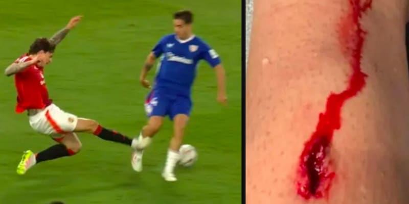 La foto raccapricciante del taglio sulla gamba in United-Athletic: "Per l'arbitro neanche fallo..." 1 La foto raccapricciante del taglio sulla gamba in United-Athletic: "Per l'arbitro neanche fallo..."