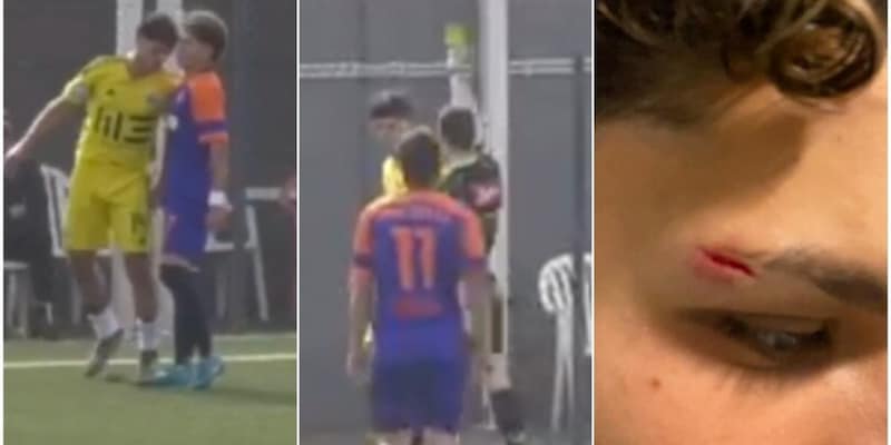 Testata a un giovane del Roma City sotto gli occhi dell'arbitro, ma niente espulsione