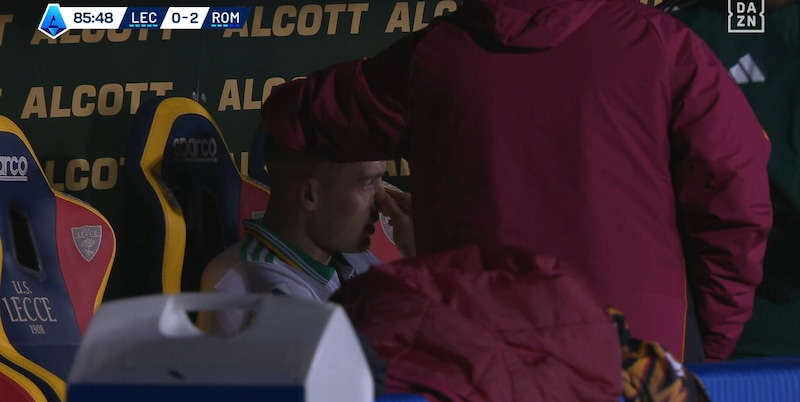 Infortunio Dovbyk, l'attaccante segna e si fa male: le telecamere lo inquadrano in lacrime in panchina