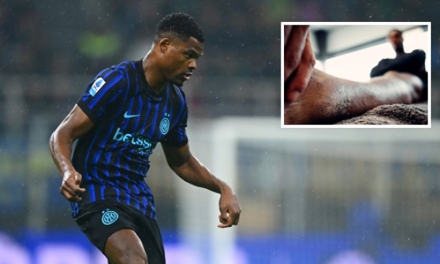 Dumfries e il suo diario dall'infortunio: "Torno prima del previsto, questa è una battaglia mentale" 4 Dumfries e il suo diario dall'infortunio: "Torno prima del previsto, questa è una battaglia mentale"