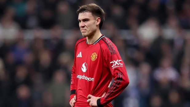 Un mediano nato attaccante che guarda avanti. Anche col trapianto di capelli: Juve, ecco Ugarte