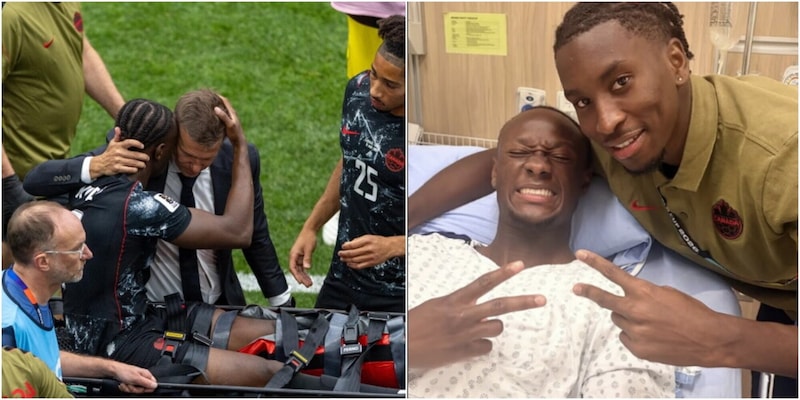 Koné operato per la frattura alla gamba: diagnosi e tempi di recupero 2 Koné operato per la frattura alla gamba: diagnosi e tempi di recupero