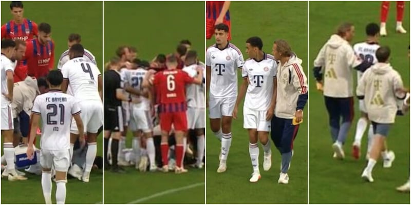 Musiala collassa di nuovo, Bayern sotto shock: otto minuti in campo poi il crollo 2 Musiala collassa di nuovo, Bayern sotto shock: otto minuti in campo poi il crollo